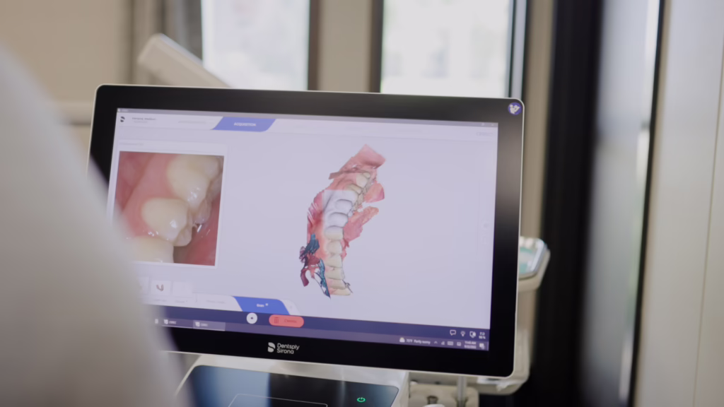 Monitor displaying dental software with a 3D upper-teeth model and an inset photo of teeth on the left.